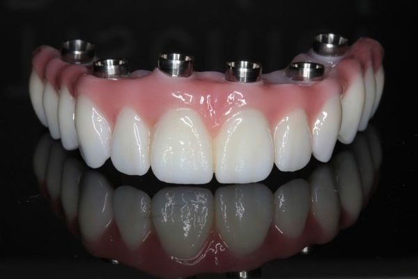 Valplast Partial Dentures Maywood MO 63454